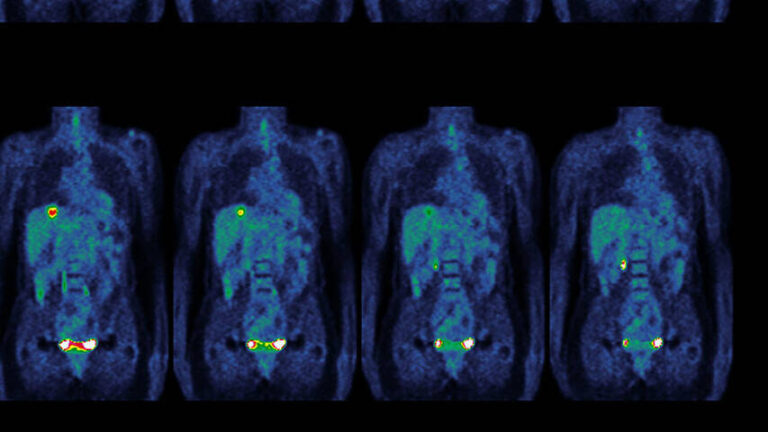 découvrez les dernières avancées en imagerie qui révolutionnent le diagnostic médical et améliorent les traitements. restez à jour sur les technologies innovantes qui transforment le paysage de la santé.