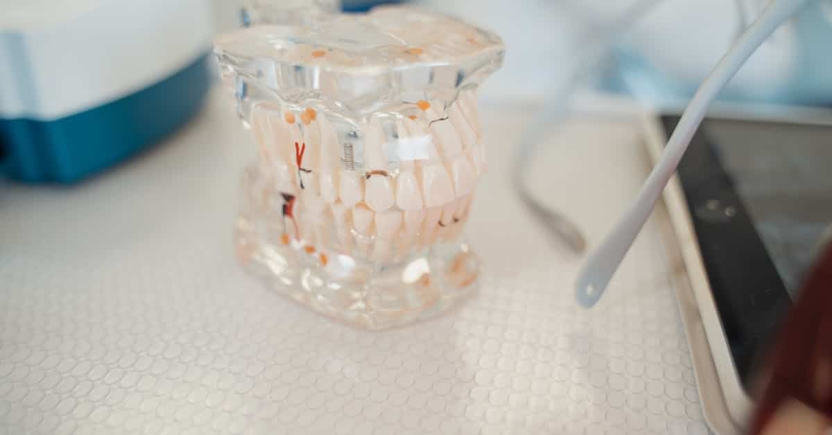 discover the world of dental prosthetics, an innovative solution to restore your smile and regain optimal dental function. our experts assist you in choosing custom prostheses tailored to your needs.